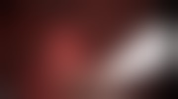 Hybrid laparoscopic/endoscopic transgastric resection of a gastric GIST