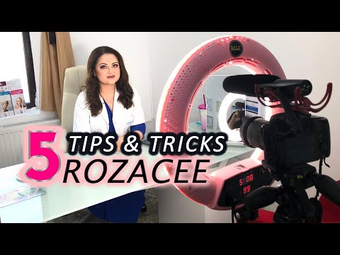 5 Tips & Tricks pentru Rozacee