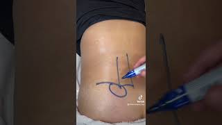 CIÁTICA, LUMBALGIA, SACROILEITIS.