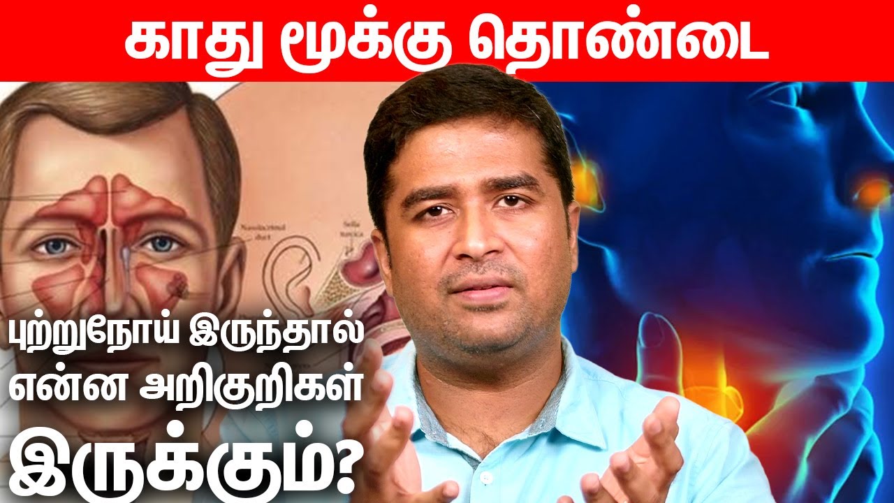 காது மூக்கு தொண்டை புற்றுநோய் இருந்தால் என்ன அறிகுறிகள் இருக்கும்? | Dr Vignesh Ent