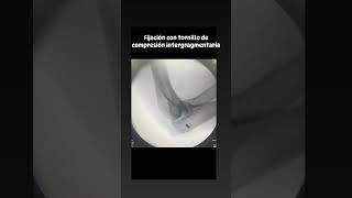 Helberth Augusto González Rico-3