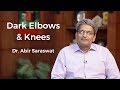 Skin Lightening Treatment For Dark Elbows & Knees | Dermatologist Dr. Abhir Saraswat | Skin Diaries