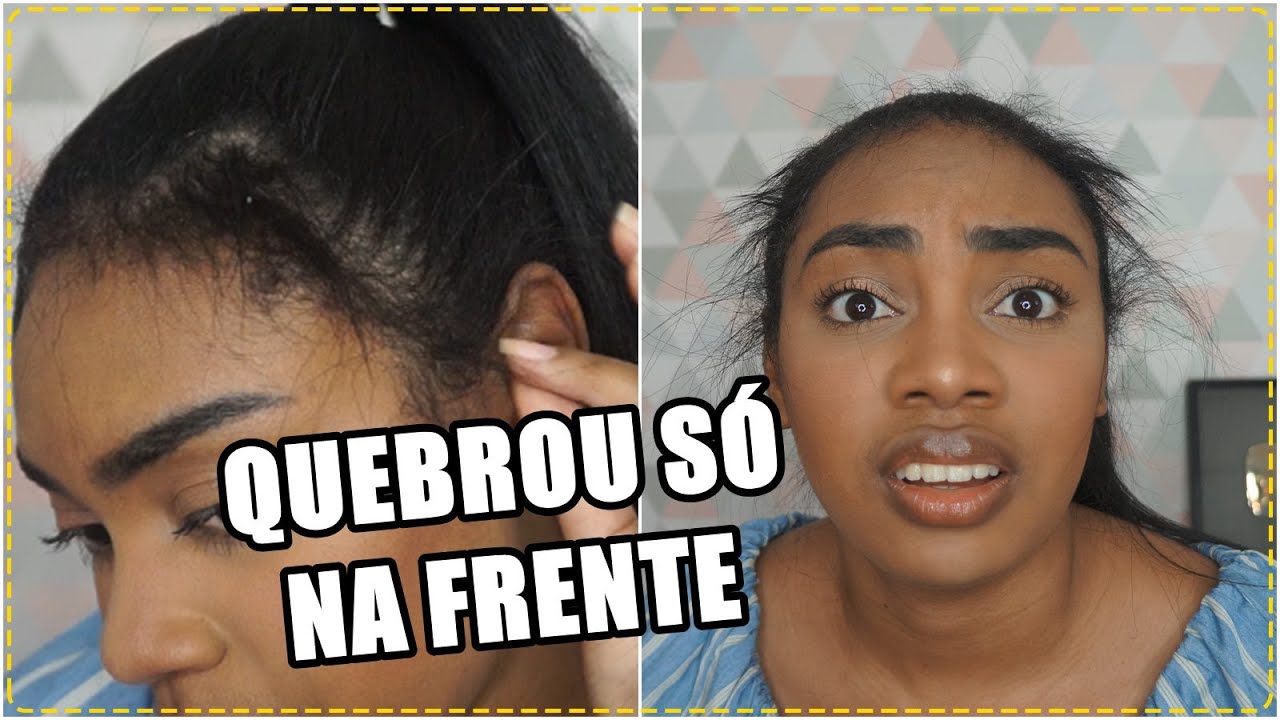 CABELO QUEBRADO NA FRENTE | COMO DISFARÇAR - thptnganamst.edu.vn