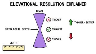 Ultrasound Physics Part 10 | Elevational Resolution & Slice Thickness Made Easy | SPI Review