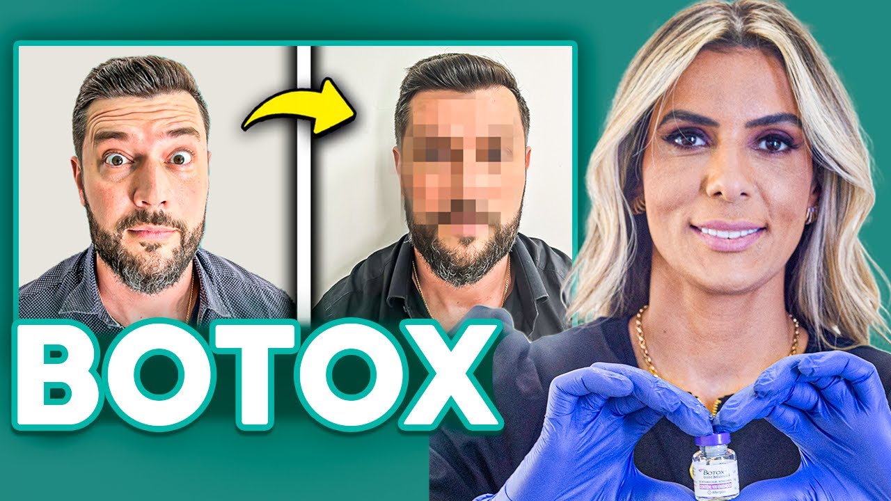 APLICAÇÃO DE BOTOX NO ROSTO: ANTES E DEPOIS