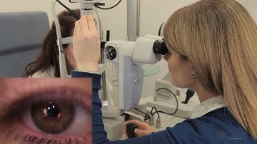 Slit Lamp Techniques   Specular Reflection