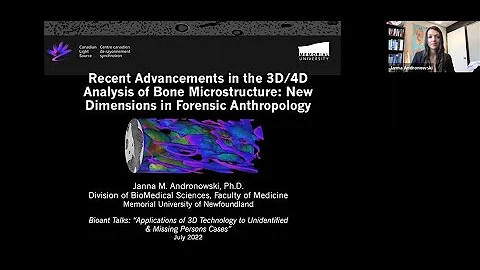 Recent Advancements in 3D/4D Analysis of Bone Microstructure New Dimensions in Forensic Anthropology