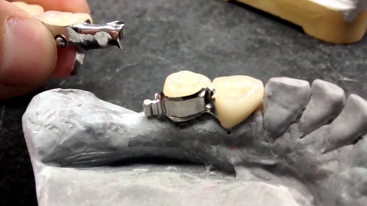 Wegold  Mini-SG Riegel