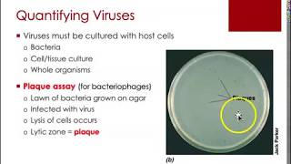 Acellular Microbes - Viruses & Prions (#5of5)
