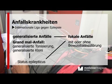 Video: Geht der anfallsartige tonische Aufblick weg?