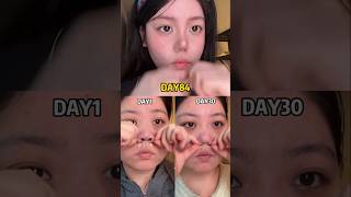 The real secret to many young women is their bulbous nose#RecordItNow#Beauty#nosestrips