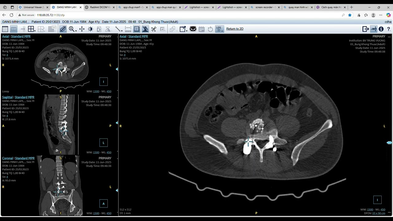 DANG MINH LAM, ,   Universal Viewer Zero Footprint Client and 9 more pages   Personal   Microsoft​ E