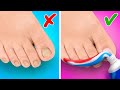 Amazing Feet Gadgets and Hacks || DIY Ideas For Your Shoes