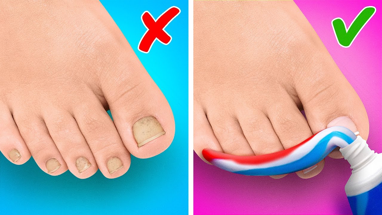 Amazing Feet Gadgets and Hacks || DIY Ideas For Your Shoes