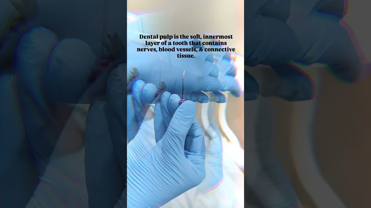 Dental Pulp is the soft, innermost layer of a tooth.