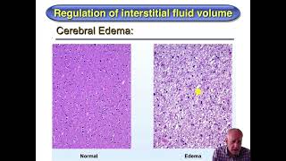 Cardiovascular Physiology Lecture 13 (Capillary Exchange, ECF Volume, Edema) Part 1