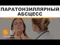 Паратонзиллярный абсцесс