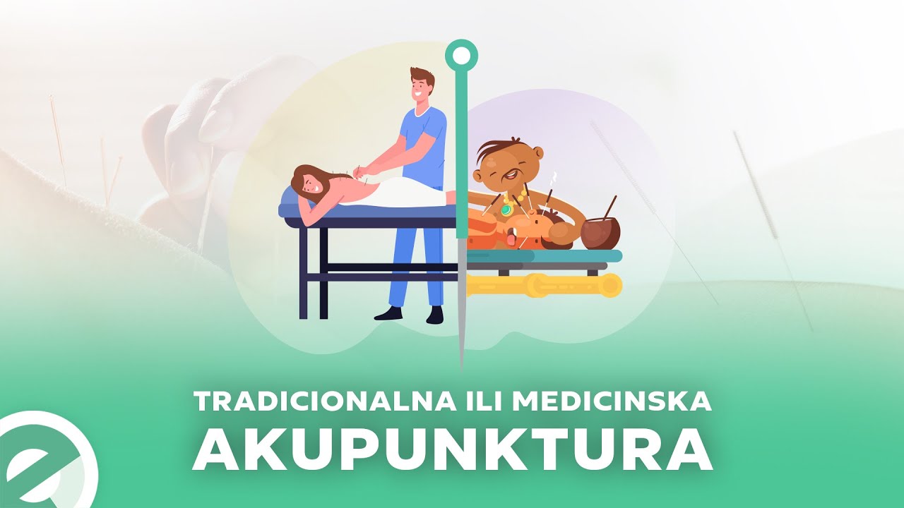 Akupunktura | Razlika izmedju kineske tradicionalne i medicinske | Ordinacija Experta |