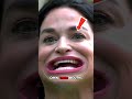 Why Can Some People Open Their Mouths So Wide 😱👄