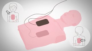 How to use an AED on a child | Paediatric First Aid Refresher | iHASCO