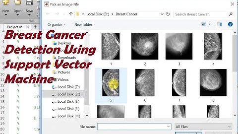 Breast Cancer Detection Using Support Vector Machine Algorithm IEEE Based Project Matlab Source Code