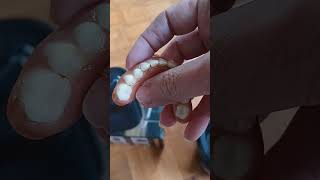 Saving money, making my own temporary denture l