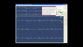 GE CardioSoft ECG System Manual Attachments into EPR - Easy User Guide screenshot 5