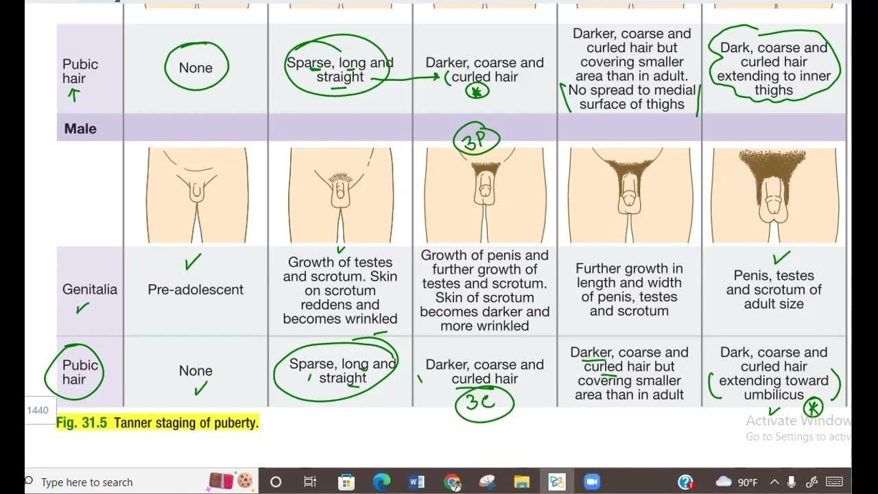 puberty girls pubic hair Normal Puberty and Pubertal Disorders | SpringerLink