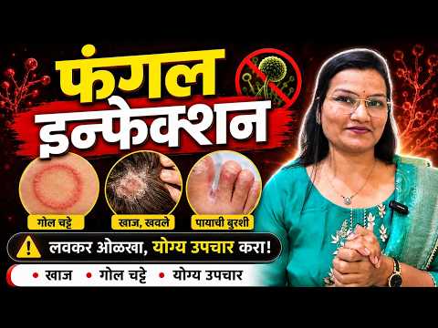 ही एक चूक फंगल इन्फेक्शन वारंवार वाढवते !