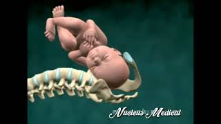 Shoulder Dystocia Birth Injury |2021| Nucleus Health