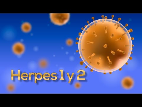 Vídeo: Remedios Caseros Para El Herpes: 37 Aceites, Hierbas, Más Para HSV-1 Y HSV-2