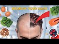 Eat These Foods to Regrow Your Hair Naturally – No More Hair Loss