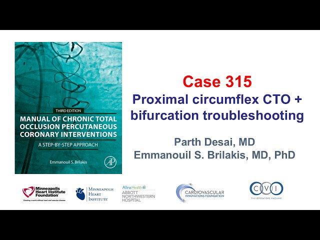 Case 315: Manual of CTO PCI - Proximal circumflex CTO and