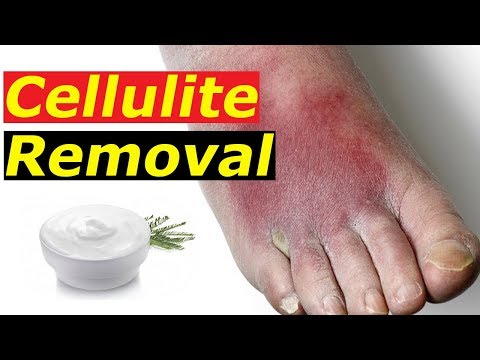 how-to-get-rid-of-cellulite-fast.