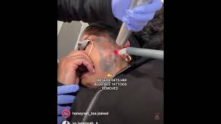 Chrisean Rock Get Blueface Tattoos Removed 😧