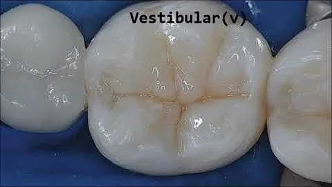 Quais são anatomicamente as divisões dos dentes?