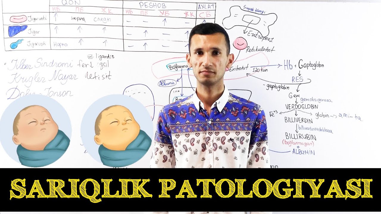 Sariqlik patofiziologiyasi. Jigarusti(gemolitik), jigar(parenximatoz), jigarosti(mexanik).