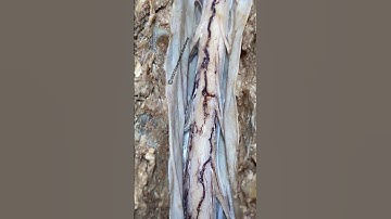 Spinal cord in situ closeup