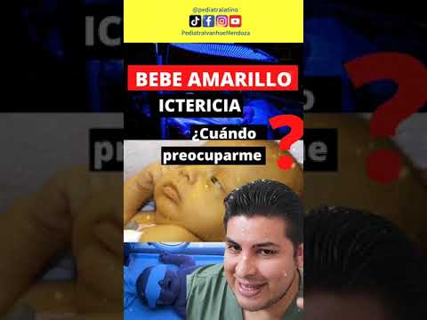 👉👶 MI BEBÉ