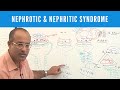 Nephrotic & Nephritic Syndrome - Causes, Symptoms & Treatment