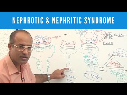 Nephrotic & Nephritic Syndrome | Causes , Symptoms & Treatment | Nephrology