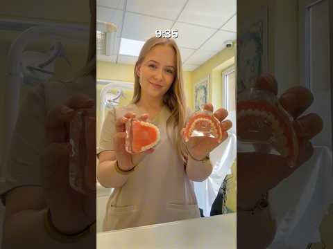 GRWM NA ZUBNÚ STÁŽ🦷 #medicine #dentistry #medstudent #lfuk #fyp #viral #nibuska #dentist #medicina