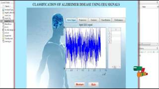 Diagnosis of Alzheimer Disease using EEG Signals | Final Year Projects 2016 - 2017