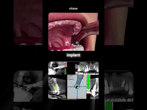 Dentist Dental Dentistry Dentiststudent Otex Dentisthygienist Dentistryworld Cosmeticdentist 