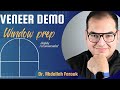 window preparation of veneer || Dr. Abdallah Farouk