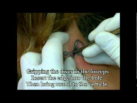 Skin Diver How To Do One Professionally Microdermal Youtube