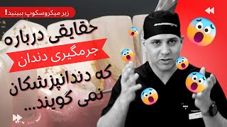 تماشای مراحل جالب جرمگیری دندان از نمای بسیار نزدیک میکروسکوپی