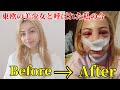 【閲覧注意】私の顔はどうしてこうなりましたか？