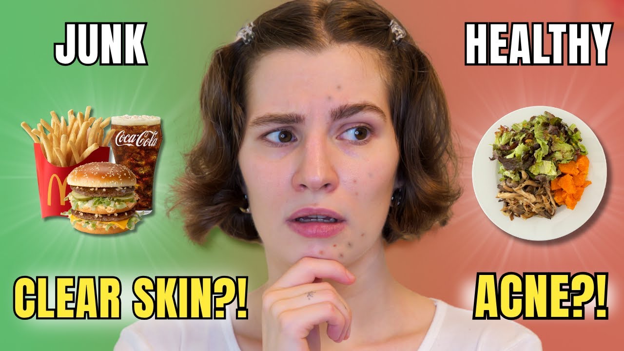 Is Healthy Food Causing Acne? When Junk Is the Safer Choice