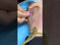 Injection Technique Made Simple | Safe & Accurate Step-by-Step Guide Class . 23